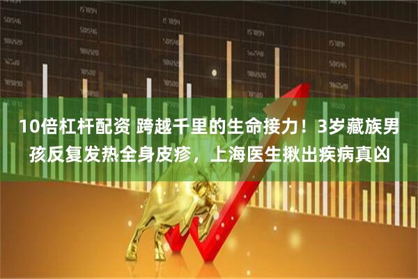 10倍杠杆配资 跨越千里的生命接力！3岁藏族男孩反复发热全身皮疹，上海医生揪出疾病真凶
